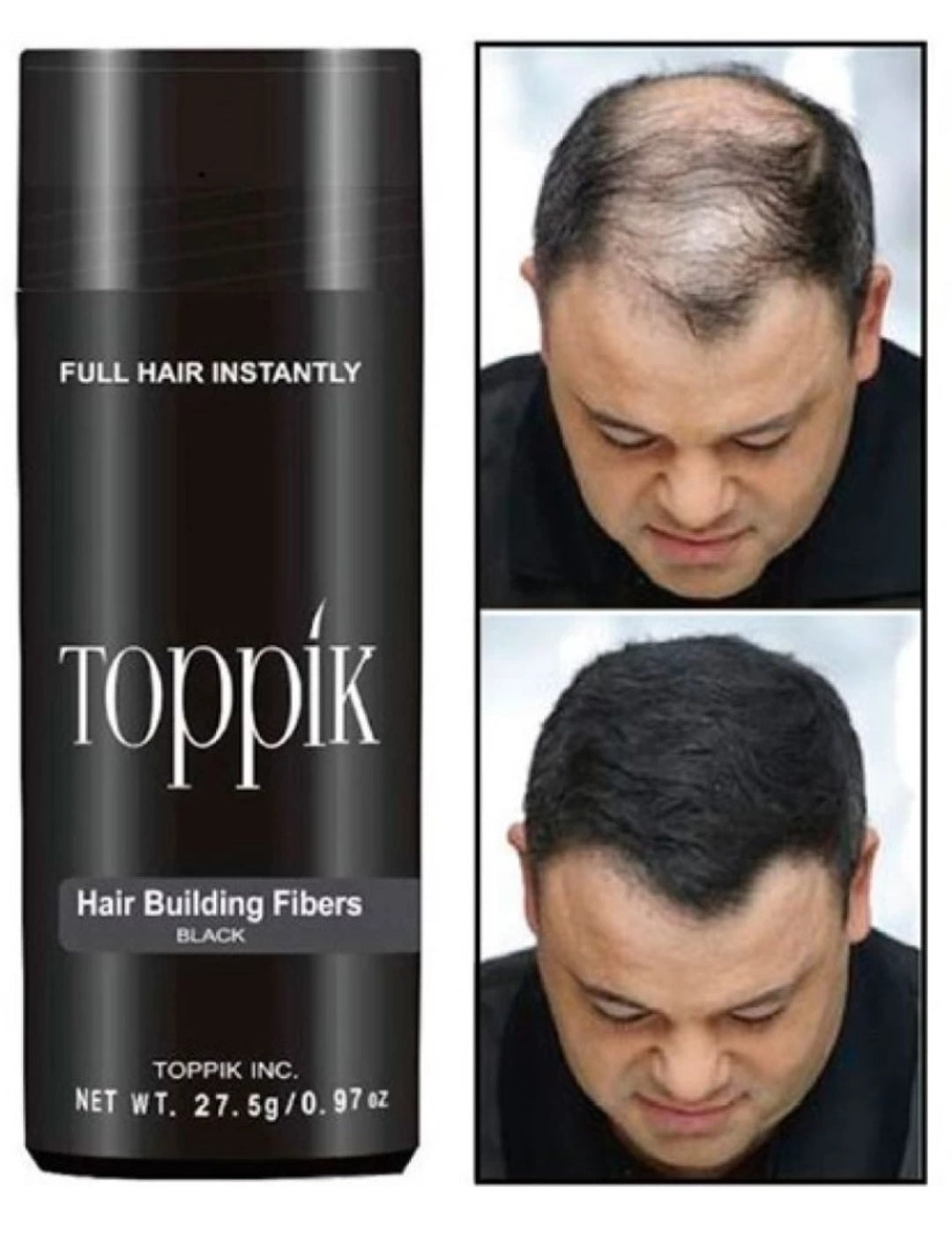 Toppik Hair Building Fibers, Keratin-Derived Fibres for Naturally Thicker Looking Hair, Cover bald spot - Black 27.5 gm